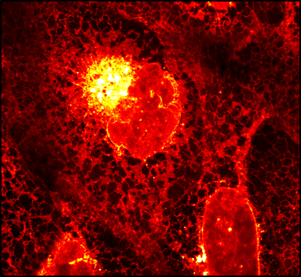 Lipid Composition